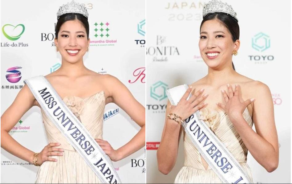 Tân Hoa hậu Hoàn vũ Nhật Bản bị chê già nua so với tuổi 20-1