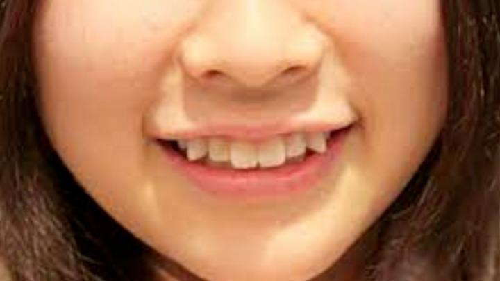 Tại sao rất nhiều người Nhật có hàm răng không đều?-1